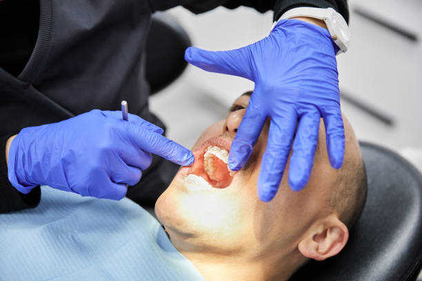 Best Chipped Tooth Repair Near Me  in Monticello, GA